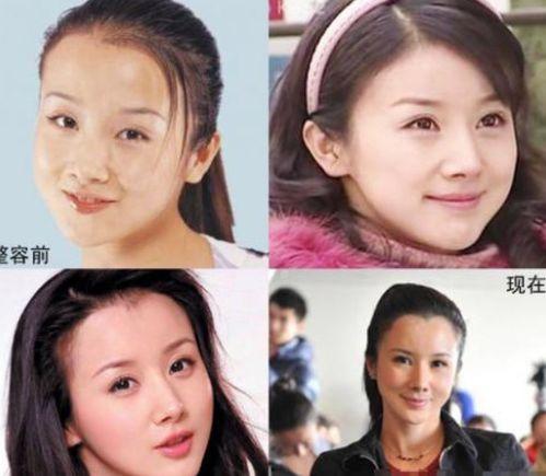 明星整容失败的图片,美丽变惊悚，盘点那些失败的整形案例